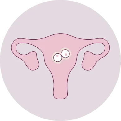 Image - of-ivf-success-icon-4-390x390.webp